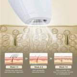 Professional Laser Epilator IPL Hair Removal Body Bikini Leg