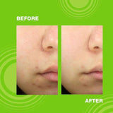 Dr. Jart+ Teatreement Soothing Spot