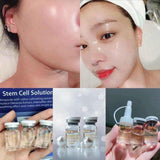 Ronas Stem Cell Solution - Kl Skincare