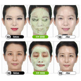 Super Vegitoks Cleanser - Kl Skincare