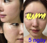 Laennec Placental Extract - Kl Skincare