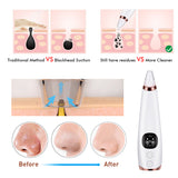 Facial microcry stalline blackhead skin beauty instrument - Kl Skincare