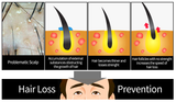 MBA Hair Loss Treatment