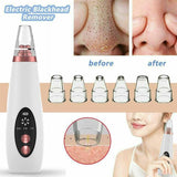 USB Blackhead Remover Face