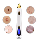 Newest Laser Plasma Pen Warts