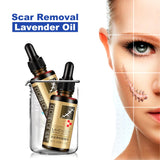 Scar Removal Serum Lavender Repair Oil For