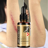 Scar Removal Serum Lavender Repair Oil For