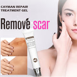 VIBRANT GLAMOUR Repair Scar Removal Cream Acne Scars Gel Stretch Marks Surgical Scar Burn For Body Pigmentation Corrector Care