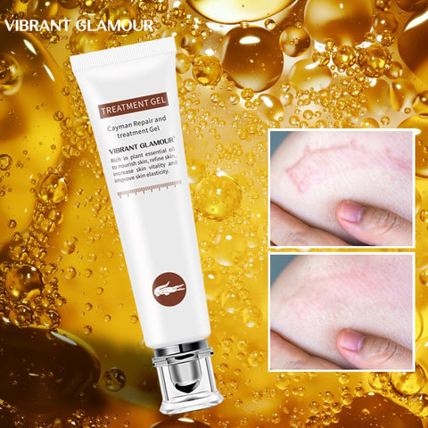 VIBRANT GLAMOUR Repair Scar Removal Cream Acne Scars Gel Stretch Marks Surgical Scar Burn For Body Pigmentation Corrector Care