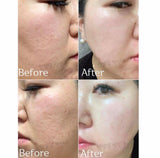 Dermatology Booster Incellderm