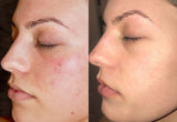 Medi-Peel 66 Days Solutions