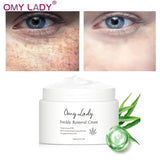 OMY LADY Freckle Removal Cream