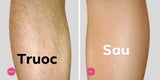 Moomo Hair Removal