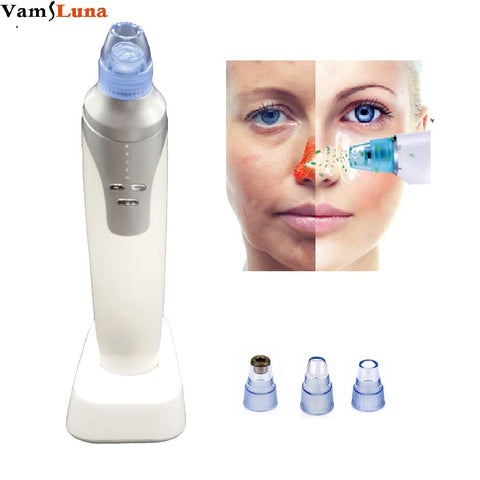 Vacuum Pore Cleaner Blackhead Remover